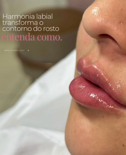 Post sobre harmonia labial