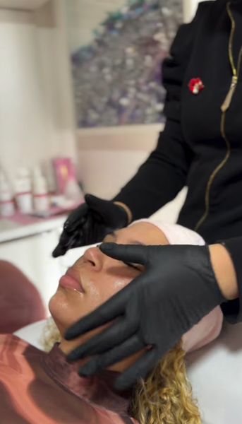 Bastidores de procedimento facial